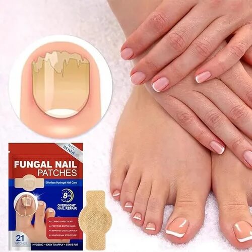 ¿Uñas dañadas, amarillas o con hongos? Recupera su apariencia mientras duermes con estos parches especializados.