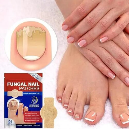 ¿Uñas dañadas, amarillas o con hongos? Recupera su apariencia mientras duermes con estos parches especializados.