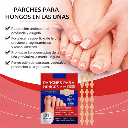 ¿Uñas dañadas, amarillas o con hongos? Recupera su apariencia mientras duermes con estos parches especializados.